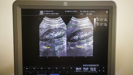 Probe convexe à ultrasons Compatible avec le scanner à ultrasons Mindray C5-2 DC-7/N6/T6